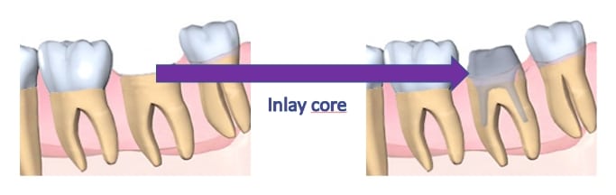 inlay-core
